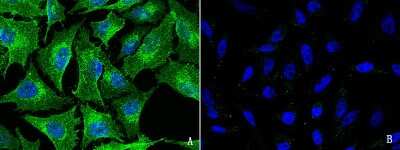 Immunocytochemistry/Immunofluorescence: FXR1 Antibody [NBP2-98797] - Immunofluorescence staining of FXR1 in HeLa cells. Cells were fixed with 4% PFA, blocked with 10% serum. Then incubated with rabbit anti-human FXR1 polyclonal antibody (1:1000)(Figure A), incubated with rabbit anti-human FXR1 polyclonal antibody and antigen (Figure B) at 4C overnight. Then cells were stained with the Alexa Fluor(R)488-conjugated Goat Anti-rabbit IgG secondary antibody (green) and counterstained with DAPI (blue). Positive staining was localized to cytoplasm.