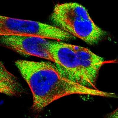 Immunocytochemistry/ Immunofluorescence FXR2 Antibody