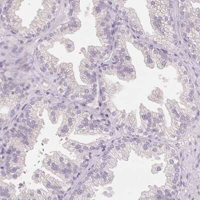 Immunohistochemistry: FXYD4 Antibody [NBP2-48725] - Staining of human prostate shows no positivity in glandular cells as expected.