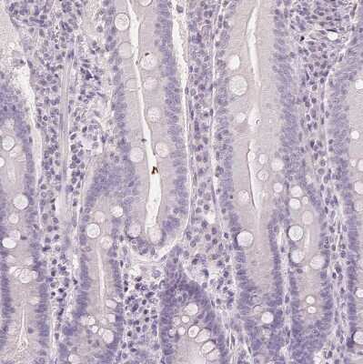 Immunohistochemistry-Paraffin: FXYD4 Antibody [NBP2-48725] - Staining of human small intestine shows no positivity in glandular cells as expected.