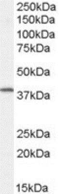 Western Blot: FXYD5/Dysadherin Antibody [NB100-1003] -  (0.5ug/ml) of Human Spleen lysate (RIPA buffer, 30ug total protein per lane). Primary incubated for 1 hour. Detected by western blot using chemiluminescence.