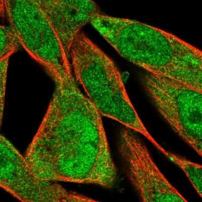 Immunocytochemistry/Immunofluorescence: FXYD6 Antibody [NBP2-59004] - Staining of human cell line RH-30 shows localization to nucleoplasm & cytosol.