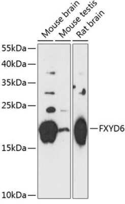 Western Blot: FXYD6 Antibody [NBP3-04818] - Analysis of extracts of various cell lines, using FxYD6 antibody at 1:3000 dilution. Secondary antibody: HRP Goat Anti-Rabbit IgG (H+L) at 1:10000 dilution. Lysates/proteins: 25ug per lane. Blocking buffer: 3% nonfat dry milk in TBST. Detection: ECL Basic Kit