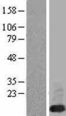 Western Blot: FXYD6 Overexpression Lysate (Adult Normal) [NBP2-10167] Left-Empty vector transfected control cell lysate (HEK293 cell lysate); Right -Over-expression Lysate for FXYD6.