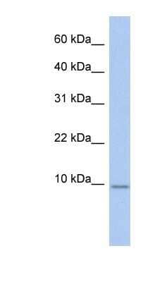 Western Blot FXYD7 Antibody