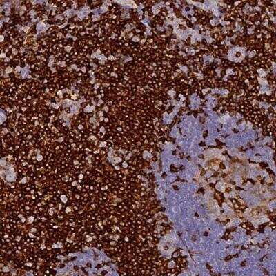 Immunohistochemistry: FYB/ADAP/SLAP130 Antibody [NBP1-91916] - Staining of human tonsil shows strong cytoplasmic positivity.