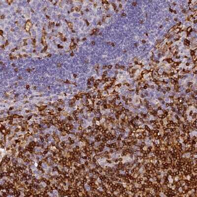 Immunohistochemistry-Paraffin: FYB/ADAP/SLAP130 Antibody [NBP1-91916] - Staining of human lymph node shows high expression.