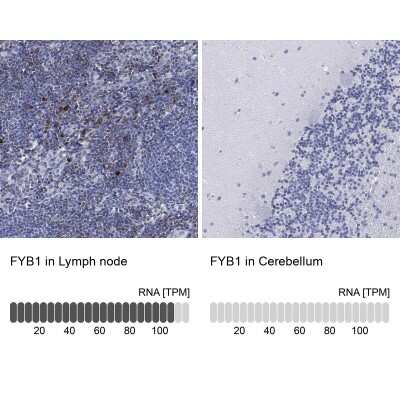 Immunohistochemistry-Paraffin: FYB/ADAP/SLAP130 Antibody [NBP3-16998] - Analysis in human lymph node and cerebellum tissues using Anti-FYB1 antibody. Corresponding FYB1 RNA-seq data are presented for the same tissues.