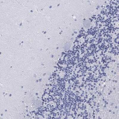 Immunohistochemistry-Paraffin: FYB/ADAP/SLAP130 Antibody [NBP3-16998] - Staining of human cerebellum shows low expression as expected.