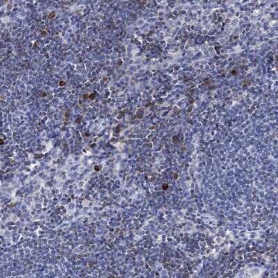 Immunohistochemistry-Paraffin: FYB/ADAP/SLAP130 Antibody [NBP3-16998] - Staining of human lymph node shows high expression.