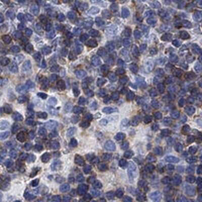 Immunohistochemistry-Paraffin: FYB/ADAP/SLAP130 Antibody [NBP3-16998] - Staining of human thymus shows cytoplasmic positivity in medullary cells.