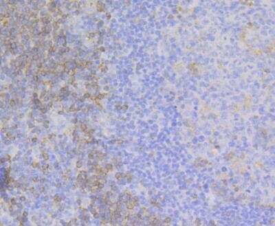 Immunohistochemistry: FYB/ADAP/SLAP130 Antibody (JE44-80) [NBP2-76882] - Immunohistochemical analysis of paraffin-embedded human appendix tissue using anti-FYB antibody. The section was pre-treated using heat mediated antigen retrieval with Tris-EDTA buffer (pH 8.0-8.4) for 20 minutes. The tissues were blocked in 5% BSA for 30 minutes at room temperature, washed with ddH2O and PBS, and then probed with the antibody at 1/200 dilution, for 30 minutes at room temperature and detected using an HRP conjugated compact polymer system. DAB was used as the chrogen. Counter stained with hematoxylin and mounted with DPX.