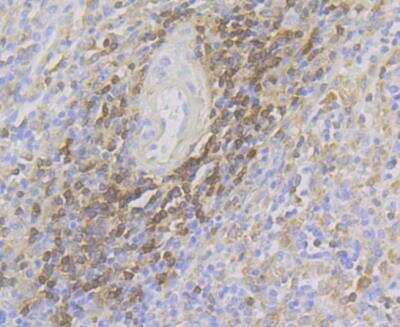 Immunohistochemistry: FYB/ADAP/SLAP130 Antibody (JE44-80) [NBP2-76882] - Immunohistochemical analysis of paraffin-embedded human spleen tissue using anti-FYB antibody. The section was pre-treated using heat mediated antigen retrieval with Tris-EDTA buffer (pH 8.0-8.4) for 20 minutes. The tissues were blocked in 5% BSA for 30 minutes at room temperature, washed with ddH2O and PBS, and then probed with the antibody at 1/200 dilution, for 30 minutes at room temperature and detected using an HRP conjugated compact polymer system. DAB was used as the chrogen. Counter stained with hematoxylin and mounted with DPX.