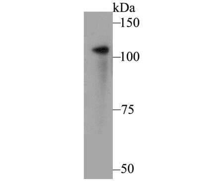 Western Blot: FYB/ADAP/SLAP130 Antibody (JE44-80) [NBP2-76882] - Western blot analysis of FYB on U937 cell lysate. Proteins were transferred to a PVDF membrane and blocked with 5% BSA in PBS for 1 hour at room temperature. The primary antibody was used at a 1:500 dilution in 5% BSA at room temperature for 2 hours. Goat Anti-Rabbit IgG - HRP Secondary Antibody (HA1001) at 1:5,000 dilution was used for 1 hour at room temperature.