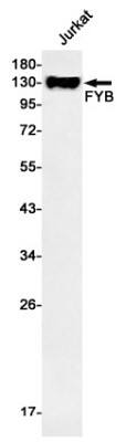 Western Blot: FYB/ADAP/SLAP130 Antibody (S03-0H1) [NBP3-19640] - Western blot detection of FYB/ADAP/SLAP130 in Jurkat cell lysates using NBP3-19640 (1:1000 diluted). Predicted band size: 85kDa. Observed band size: 120-130kDa.