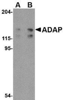 Western Blot: FYB/ADAP/SLAP130 Antibody [NBP1-76810] - K562 cell lysate with FYB antibody at (A) 0.5 and (B) 1 ug/ml.