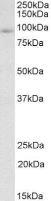 Western Blot: FYB/ADAP/SLAP130 Antibody [NBP2-26103] - Staining of MOLT4 lysate (35 ug protein in RIPA buffer). Primary incubation was 1 hour. Detected by chemiluminescence.  