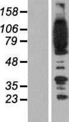 Western Blot: FYB Overexpression Lysate (Adult Normal) [NBP2-08205] Left-Empty vector transfected control cell lysate (HEK293 cell lysate); Right -Over-expression Lysate for FYB.