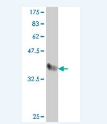 Western Blot: Factor IX Antibody [H00002158-A01] - Detection against Immunogen (36.56 KDa) .