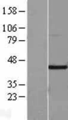 Western Blot: Factor Inhibiting HIF-1 Overexpression Lysate (Adult Normal) [NBL1-11541] Left-Empty vector transfected control cell lysate (HEK293 cell lysate); Right -Over-expression Lysate for Factor Inhibiting HIF-1.