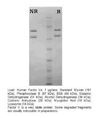 SDS-Page: Factor V Native Protein [NBP2-12562]