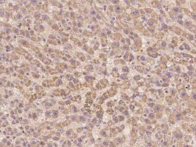 Immunohistochemistry-Paraffin: Factor VIII Antibody [NBP2-99651] - Immunochemical staining of human Factor VIII in human liver with rabbit polyclonal antibody at 1:500 dilution, formalin-fixed paraffin embedded sections.