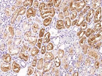 Immunohistochemistry-Paraffin: Factor XII heavy chain Antibody [NBP2-99473] - Immunochemical staining of human Factor XII heavy chain in human kidney with rabbit polyclonal antibody at 1:300 dilution, formalin-fixed paraffin embedded sections.