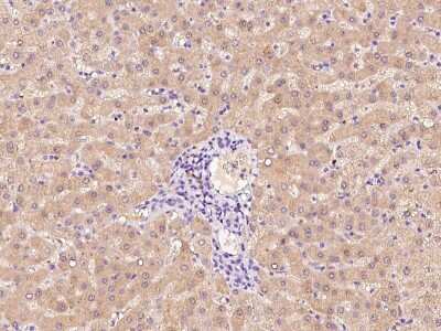 Immunohistochemistry-Paraffin: Factor XII heavy chain Antibody [NBP2-99473] - Immunochemical staining of human Factor XII heavy chain in human liver with rabbit polyclonal antibody at 1:300 dilution, formalin-fixed paraffin embedded sections.