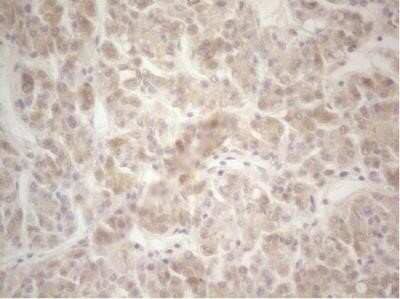 Immunohistochemistry: Factor XII heavy chain Antibody (OTI1H5) - Azide and BSA Free [NBP2-70695] - Staining of paraffin-embedded Human liver tissue using anti-F12 mouse monoclonal antibody.