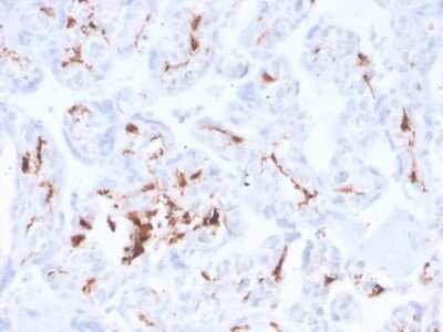 Immunohistochemistry-Paraffin: Factor XIIIa Antibody (F13A1/3772R) - Azide and BSA Free [NBP3-08933] - Formalin-fixed, paraffin-embedded human placenta stained with Factor XIIIa Recombinant Rabbit Monoclonal Antibody (F13A1/3772R).