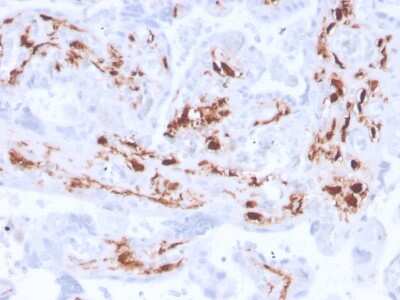 Immunohistochemistry-Paraffin: Factor XIIIa Antibody (F13A1/3772R) - Azide and BSA Free [NBP3-08933] - Formalin-fixed, paraffin-embedded human placenta stained with Factor XIIIa Recombinant Rabbit Monoclonal Antibody (F13A1/3772R).