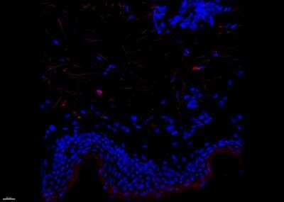Immunohistochemistry-Frozen: Factor XIIIa Antibody (SPM180) [Alexa Fluor® 488] [NBP2-54480AF488] - Huma skin section stained for FXIIIa+ interstitial dendritic cells (red) and counter-stained with DAPI (blue). Image from a verified customer review.