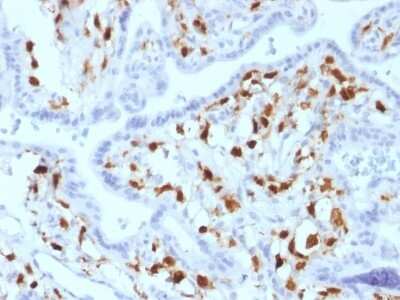 Immunohistochemistry-Paraffin: Factor XIIIa Antibody (SPM180) - Azide and BSA Free [NBP2-54480] - Formalin-fixed, paraffin-embedded human Placenta stained with Factor XIIIa Mouse Monoclonal Antibody (SPM180).