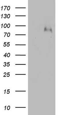 Western Blot: Factor XIIIb Antibody (OTI1A3) - Azide and BSA Free [NBP2-70697] - Analysis of HEK293T cells were transfected with the pCMV6-ENTRY control (Left lane) or pCMV6-ENTRY Factor XIII.