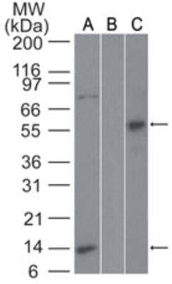 Western Blot: Fas/TNFRSF6/CD95 Antibody [NBP2-29474] - Analysis of Fas/TNFRSF6/CD95 in Jurkat lysate in the A) absence and B) presence of immunizing peptide and C) recombinant Fas/TNFRSF6/CD95-GST protein probed with 2 ug/ml of Fas/TNFRSF6/CD95 antibody. Goat anti-rabbit Ig HRP secondary antibody and PicoTect ECL substrate solution were used for this test.