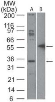 Western Blot: Fas/TNFRSF6/CD95 Antibody - Azide and BSA Free [NBP2-33118] - Analysis of Fas/TNFRSF6/CD95 in A) Jurkat lysate and B) recombinant Fas/TNFRSF6/CD95-GST protein probed with 2 ug/ml of Fas/TNFRSF6/CD95 antibody.  Goat anti-rabbit Ig HRP secondary antibody and PicoTect ECL substrate solution were used for this test.    The ~35kD band seen in Jurkat lysate is blocked by the immunizing peptide.