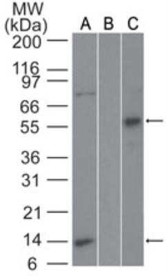 Western Blot: Fas/TNFRSF6/CD95 Antibody - Azide and BSA Free [NBP2-33120] - Analysis of Fas/TNFRSF6/CD95 in Jurkat lysate in the A) absence and B) presence of immunizing peptide and C) recombinant Fas/TNFRSF6/CD95-GST protein probed with 2 ug/ml of Fas/TNFRSF6/CD95 antibody. Goat anti-rabbit Ig HRP secondary antibody and PicoTect ECL substrate solution were used for this test.