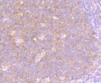 Immunohistochemistry-Paraffin: Fas Receptor/TNFRSF6/CD95 Antibody (JJ0942) [NBP2-66831] - Fas/TNFRSF6/CD95 Antibody (JJ0942) [NBP2-66831] - Analysis of paraffin-embedded human tonsil tissue using anti-Fas antibody. Counter stained with hematoxylin.