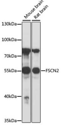 Western Blot: Fascin 2 Antibody [NBP3-03441] - Analysis of extracts of various cell lines, using Fascin 2 antibody at 1:1000 dilution. Secondary antibody: HRP Goat Anti-Rabbit IgG (H+L) at 1:10000 dilution. Lysates/proteins: 25ug per lane. Blocking buffer: 3% nonfat dry milk in TBST. Detection: ECL Basic Kit.