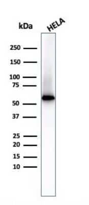 Western Blot: Fascin Antibody (FSCN1/417) - Azide and BSA Free [NBP2-47801] - Western Blot of HeLa cell lysate Using Fascin antibody (FSCN1/417)