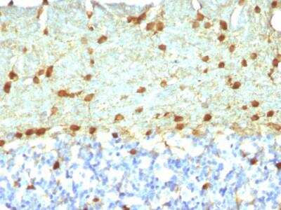 Immunohistochemistry-Paraffin: Fascin Antibody (FSCN1/418) - IHC-Prediluted [NBP2-48337] - Formalin-fixed, paraffin-embedded Rat Brain stained with Fascin-1 Mouse Monoclonal Antibody (FSCN1/418).