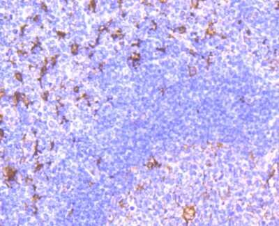 Immunohistochemistry-Paraffin: Fascin Antibody (JM12-53) [NBP2-66832] - Analysis of paraffin-embedded human tonsil tissue using anti-Fascin antibody. Counter stained with hematoxylin.