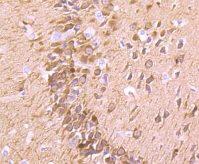 Immunohistochemistry-Paraffin: Fascin Antibody (JM12-53) [NBP2-66832] - Analysis of paraffin-embedded rat brain tissue using anti-Fascin antibody. Counter stained with hematoxylin.