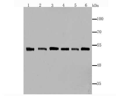 Western Blot: Fascin Antibody (JM12-53) [NBP2-66832] - Analysis of Fascin on different lysates using anti-Fascin antibody at 1/1,000 dilution. Positive control: Lane1: SH-SY5Y  Lane2: Human brain  Lane3: Rat spleen  Lane4: Mouse testes Lane5: Mouse brain Lane6: Mouse spleen