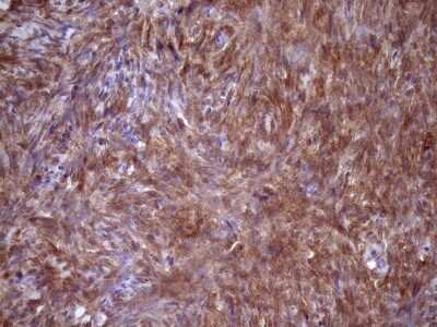 Immunohistochemistry: Fascin Antibody (OTI3B4) - Azide and BSA Free [NBP2-71294] - Analysis of Human Ovary tissue. (Heat-induced epitope retrieval by Tris-EDTA, pH8.0)