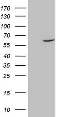 Western Blot: Fascin Antibody (OTI3B4) - Azide and BSA Free [NBP2-71294] - Analysis of HEK293T cells were transfected with the pCMV6-ENTRY control (Left lane) or pCMV6-ENTRY Fascin.