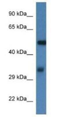 Western Blot: Fascin Antibody [NBP1-74212] - Mouse Thymus Lysate 1ug/ml Gel Concentration 12%
