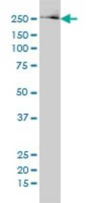 Western Blot: Fatty Acid Synthase/FASN Antibody (3F2-1F3) [H00002194-M01] - FASN monoclonal antibody (M01), clone 3F2-1F3 Analysis of FASN expression in 293.