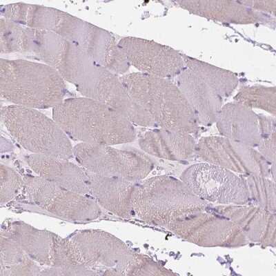 Immunohistochemistry-Paraffin: Fatty Acid Synthase/FASN Antibody [NBP1-84733] - Staining of human skeletal muscle shows low expression as expected.