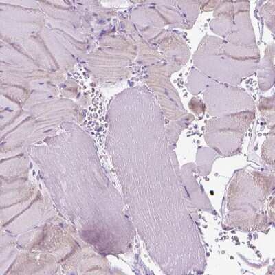 Immunohistochemistry-Paraffin: Fatty Acid Synthase/FASN Antibody [NBP2-49213] - Staining of human skeletal muscle shows low expression as expected.